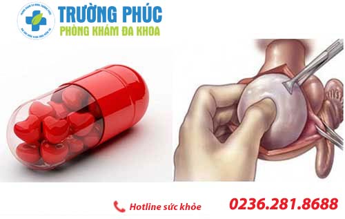 Hỗ trợ chữa u xơ tử cung bằng phương pháp nào thì hiệu quả?