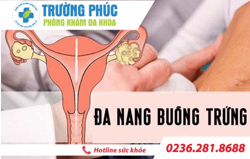 Dấu hiệu và phương pháp điều trị bệnh đa nang buồng trứng hiện nay là gì?