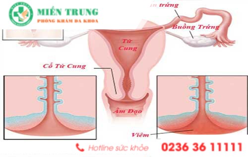 dung chu quan voi dau bung kinh