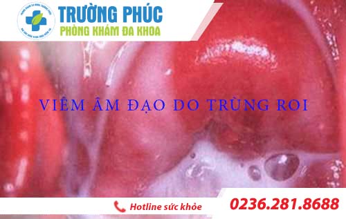 hinh anh benh viem am dao o nu gioi
