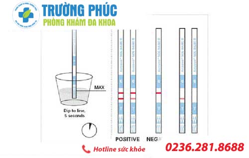 que thu thai xuat hien mot vach dam mot vach mo nghia la the nao 