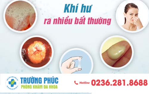 Tại sao khí hư tiết ra nhiều?
