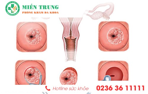 khi hu mau den do dau