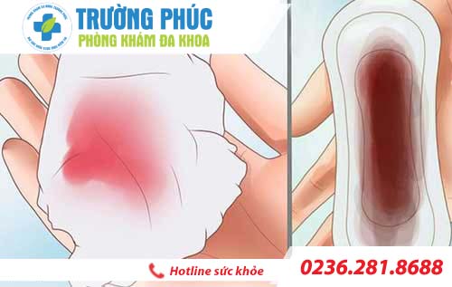 Kinh nguyệt màu đen tiềm ẩn bệnh phụ khoa nào ?