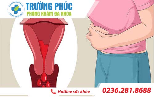 Kinh nguyệt ra nhiều do đâu?