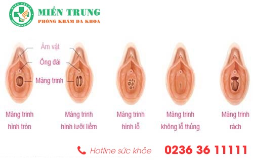 mang trinh o nu gioi co vai tro nhu the nao