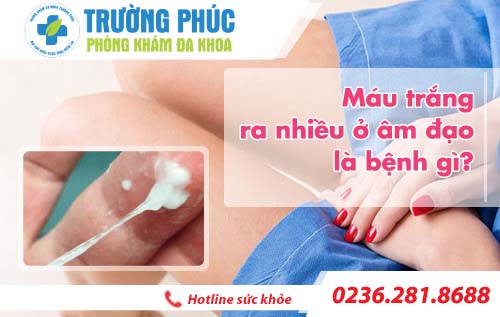 Máu trắng ra nhiều ở âm đạo là bệnh gì?