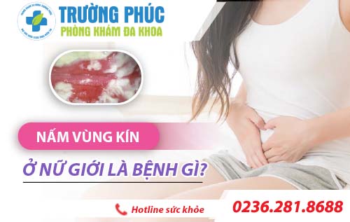Nấm vùng kín ở nữ giới là bệnh gì?