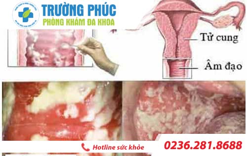 nam phu khoa va nhung dieu phu nu can biet 