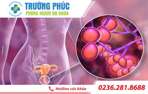 Ngứa âm đạo là dấu hiệu của những bệnh nào?