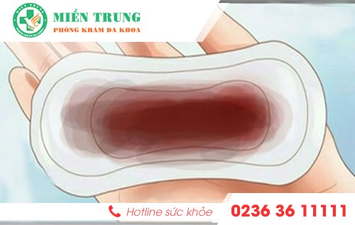 kinh nguyet mau nau do dau