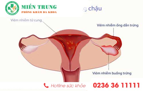 nguyen nhan va dau hieu nhan biet benh viem vung chau