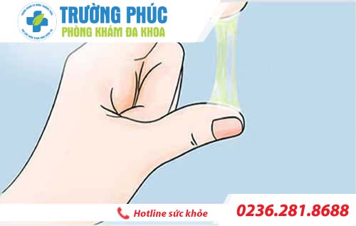 dau hieu nhan biet vo sinh o nu gioi