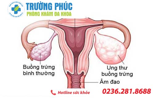 nhan biet u nang buong trung