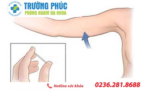 bien phap tranh thai o nu gioi