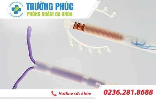 Những lưu ý cần biết khi sử dụng phương pháp đặt vòng tránh thai