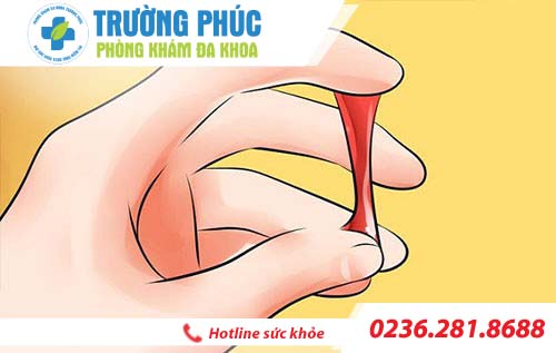 Ra máu sau khi quan hệ có sao không?