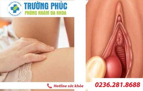 Nguyên nhân và cách chữa sưng âm đạo ở nữ giới