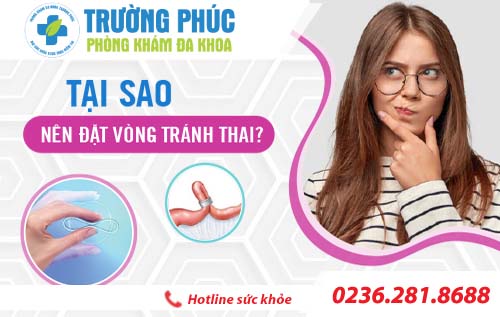 Tại sao nên đặt vòng tránh thai?