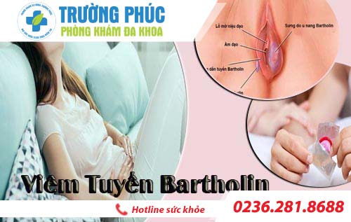 Viêm tuyến bartholin là gì và có nguy hiểm không