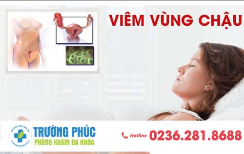 Viêm vùng chậu là bệnh gì?