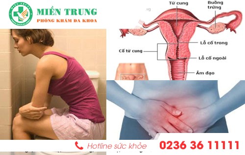 Hình ảnh có liên quan