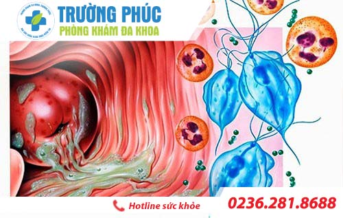 vung kin co mui hoi la benh gi